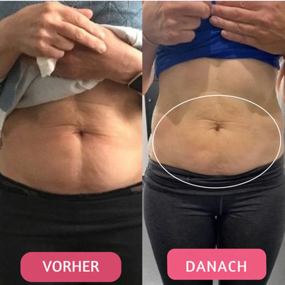 Healthierly™ Fettverbrennender Gürtel