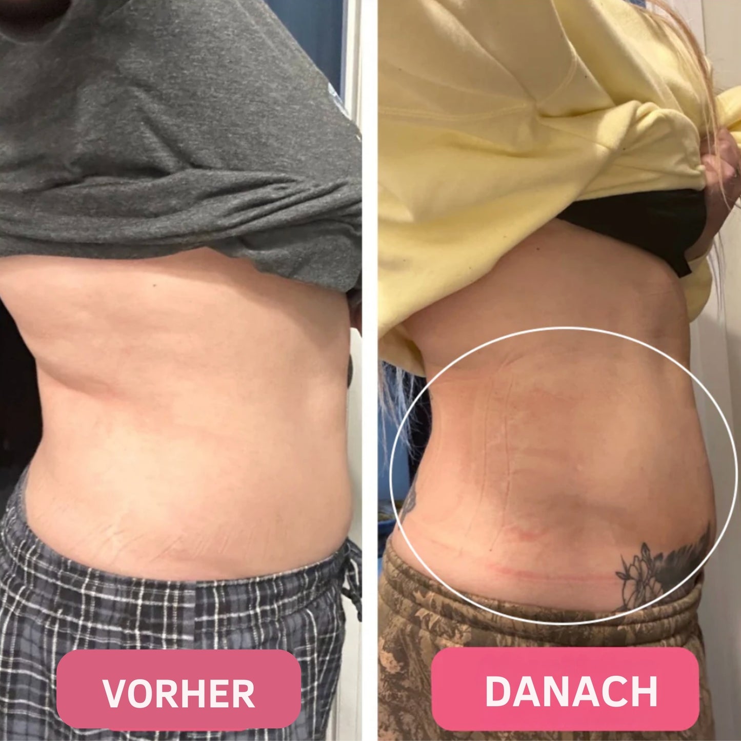 Healthierly™ Fettverbrennender Gürtel