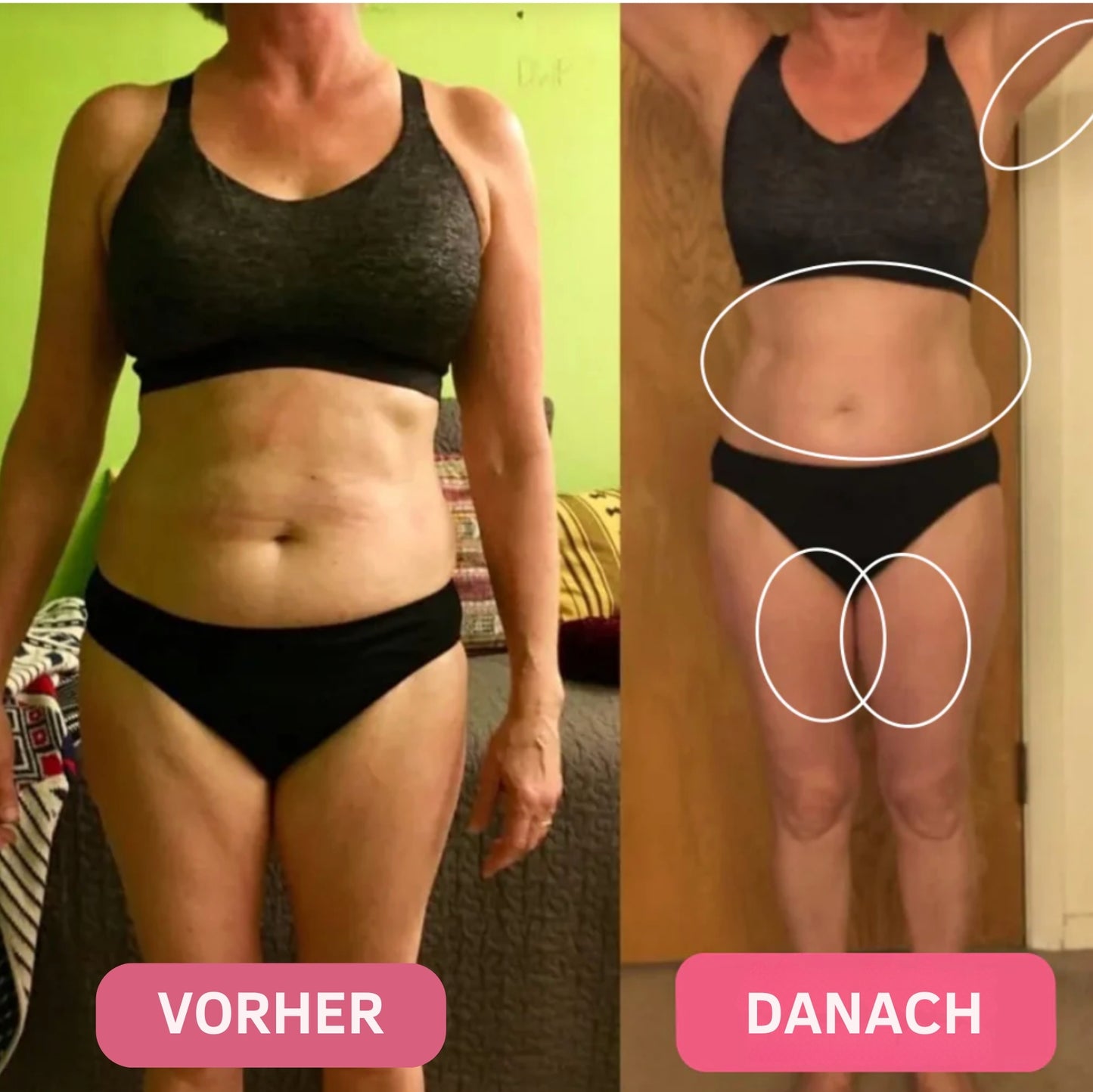 Healthierly™ Fettverbrennender Gürtel
